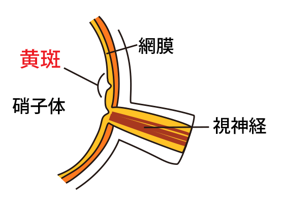 白内障の原因