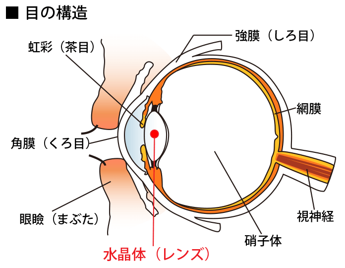 白内障の原因