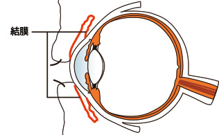 結膜の病気とは