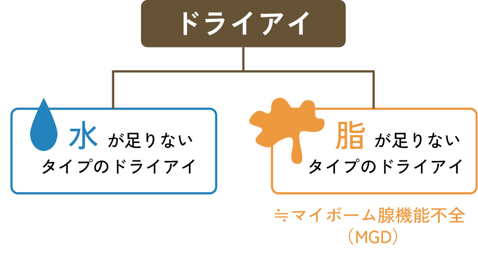 ドライアイのタイプ「水分が足りないタイプ」と「油分（あぶら）が足りないタイプ」