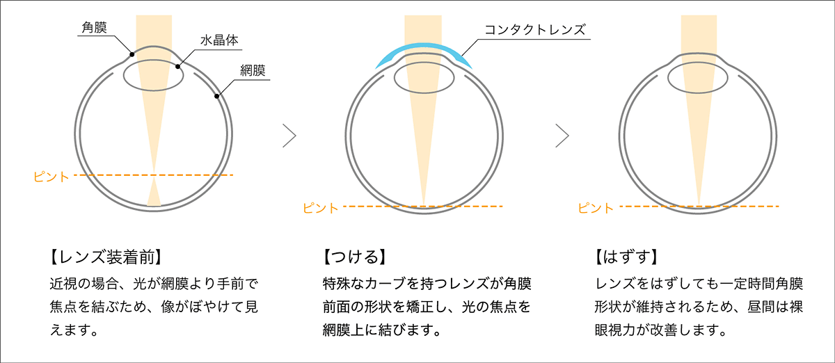 治療の流れ